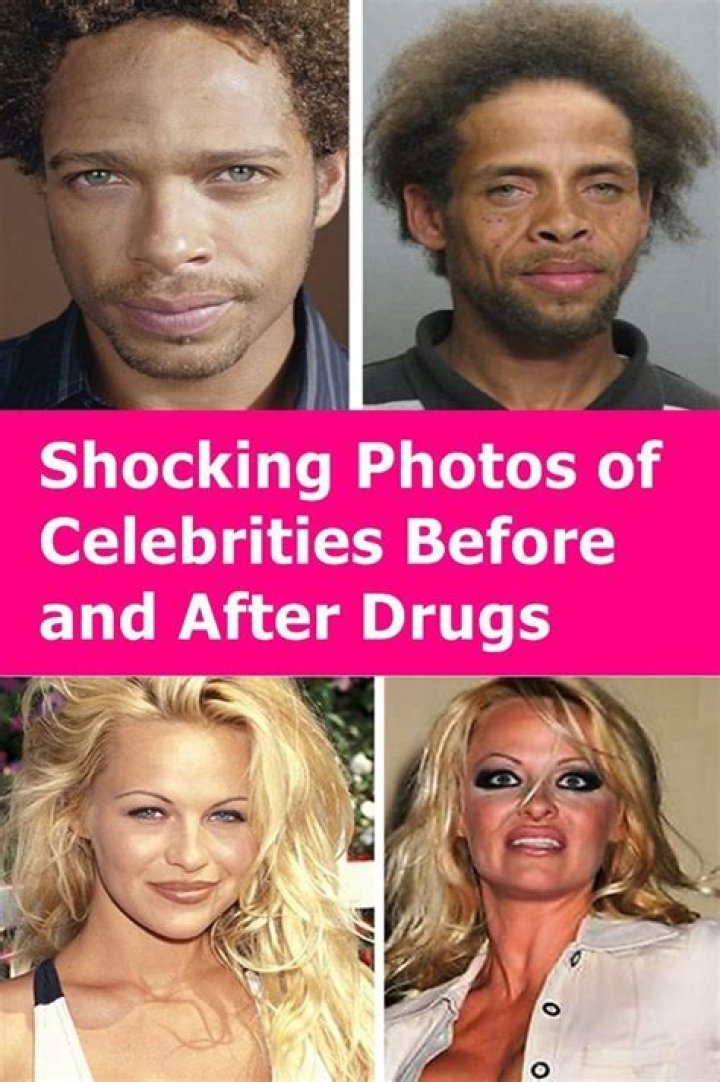 16 Shocking Celebrity Before & After Transformations Page 12 of 16