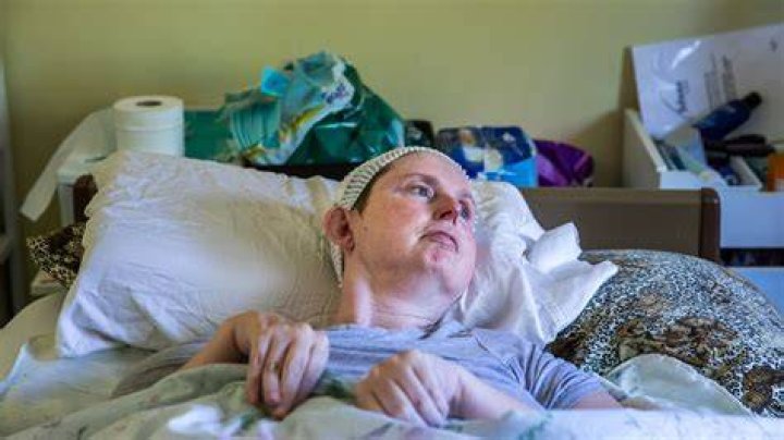 AI Helps a Stroke Patient Speak Again, a Milestone for Tech and