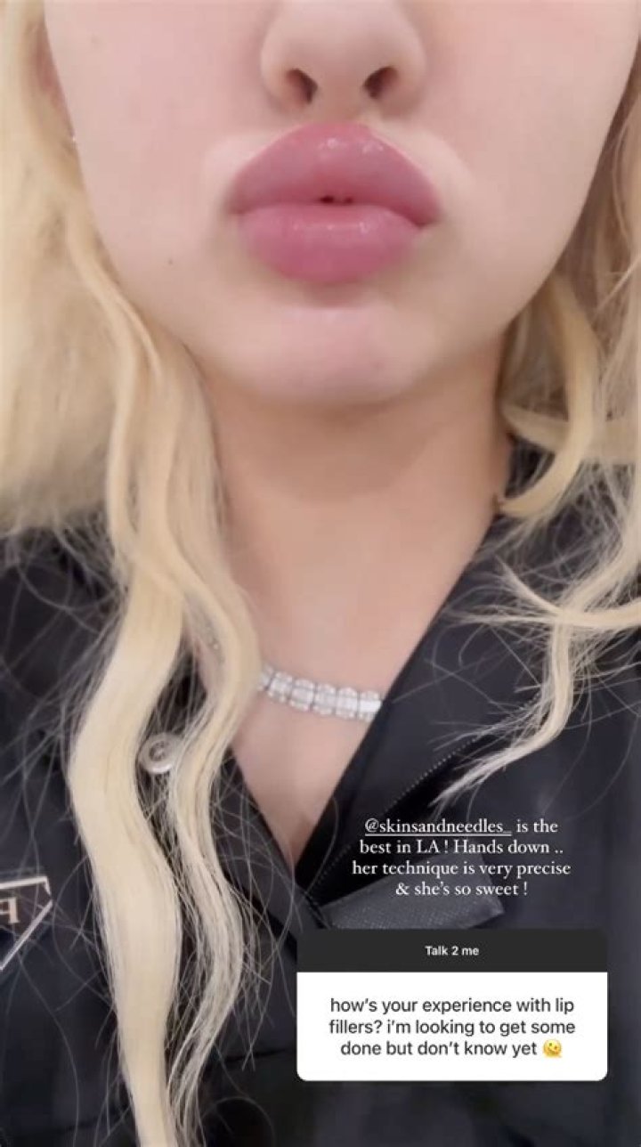 Alabama Barker, 17, sparks concern with plastic surgery confession in