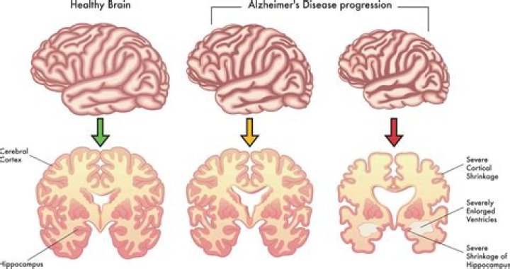 Alzheimer's Assoc. on Twitter "Thank you for continuing to share your