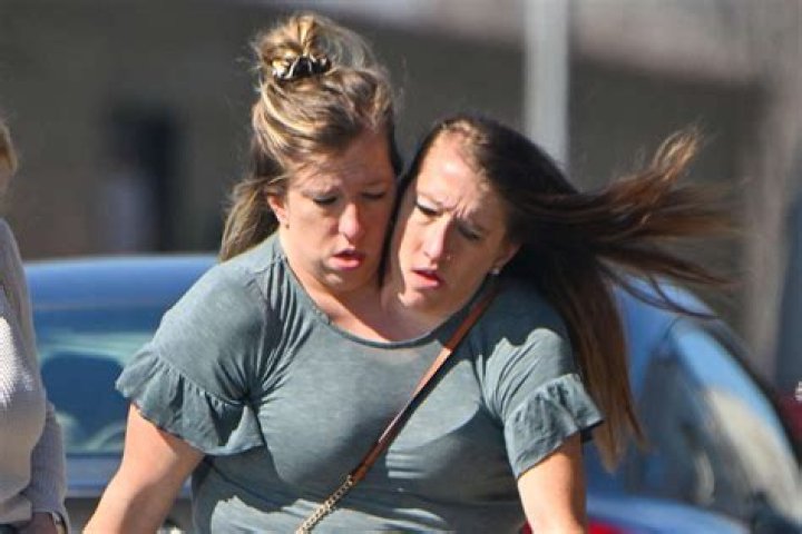 Are Abby And Brittany Hensel Still Alive 2024 Jacqui Nissie