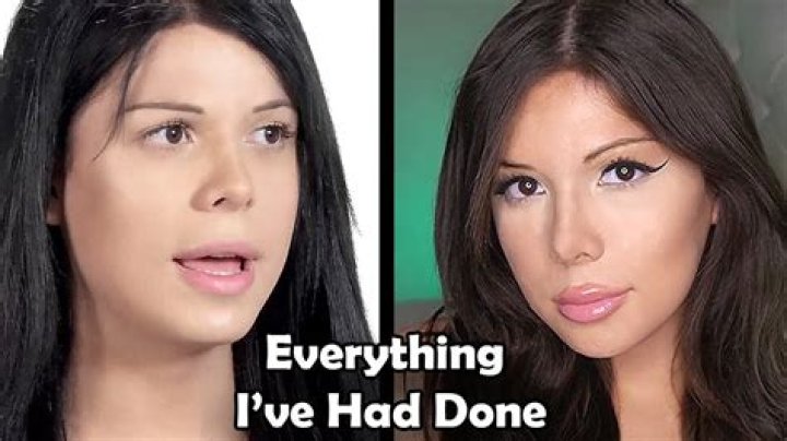 Blaire White before after transition changes [transgender] YouTube