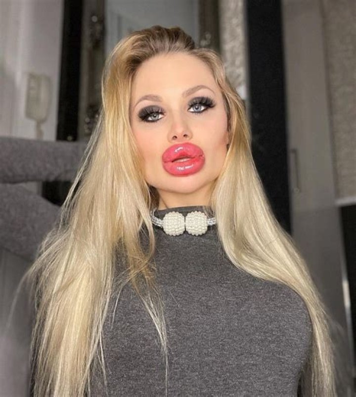 Brielle Biermann&rsquo;s Huge Lips Slammed For Looking Like She Had &lsquo;An
