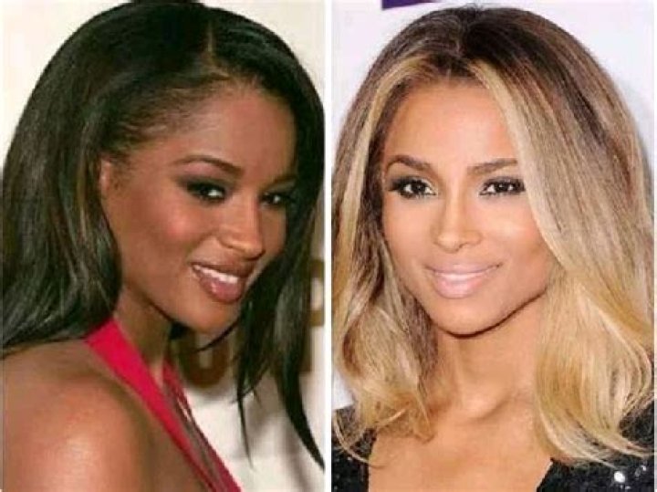 Celebrities Who Bleached Their Skin