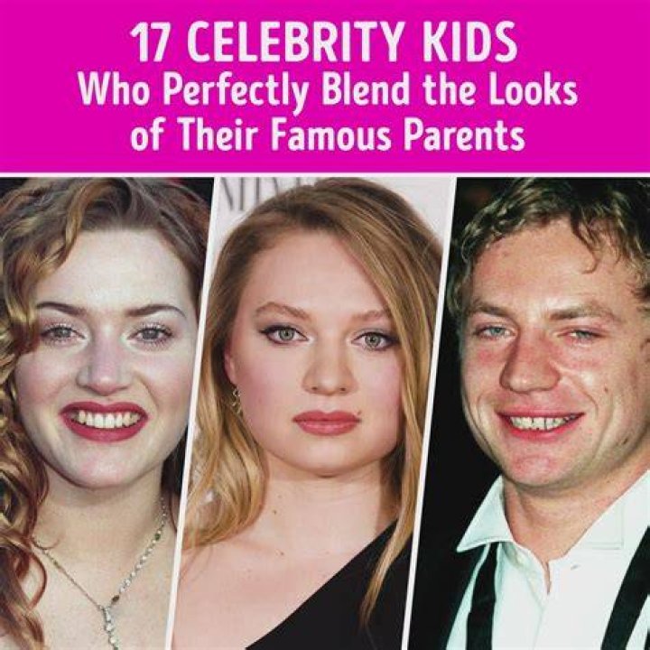 Celebrity Parents Of Children With Down Syndrome The Clooney Twins