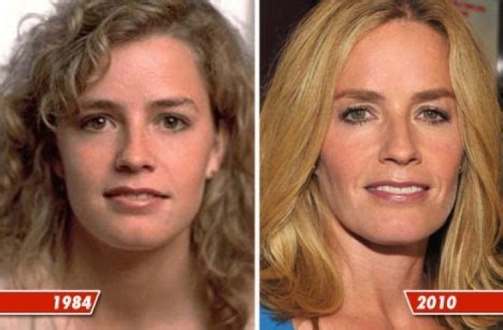 Chatter Busy Elisabeth Shue Plastic Surgery