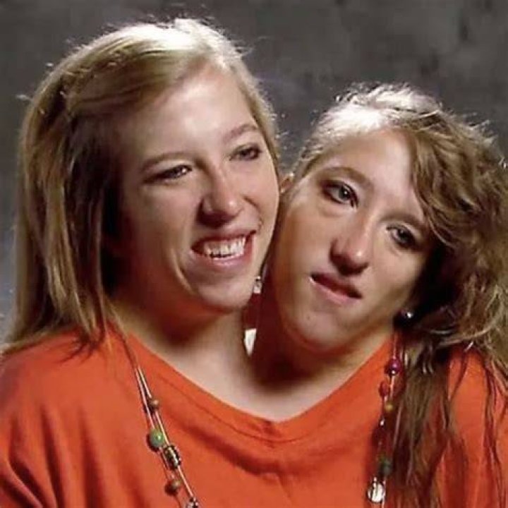 Conjoined twins Abby and Brittany Hensel talk challenge in personal