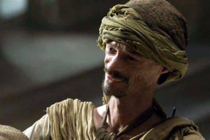 Darren Kent Illness "GOT" Actor's Skin Disorder And Other Health Issues