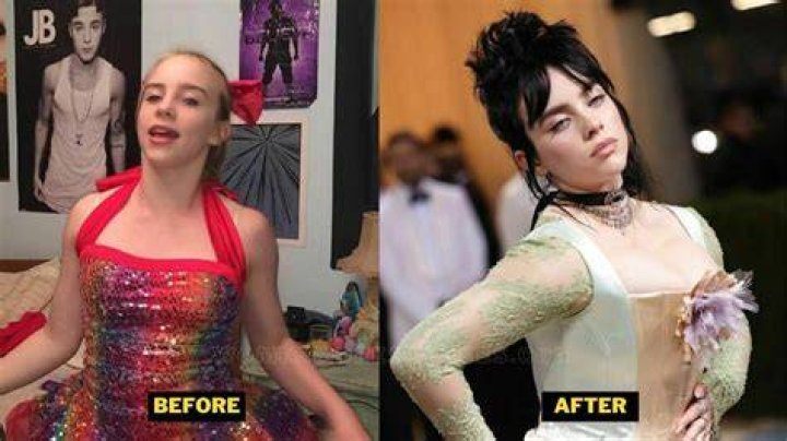 Did Billie Eilish have Plastic Surgery? Nose Job, Body Measurements