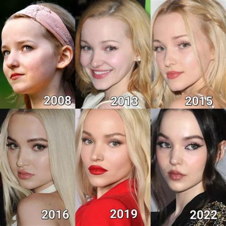 Did Dove Cameron Get Plastic Surgery? Check Out The Descendants Star's