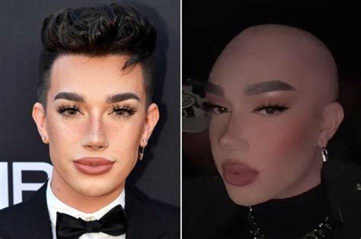 Did James Charles really go bald? Why fans think he shaved his head Hot Lifestyle News