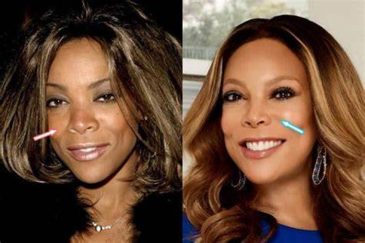 Did Wendy Williams Get Plastic Surgery? (Before & After 2018)
