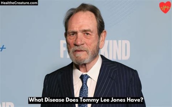 Does Tommy Lee Jones have Cancer? TRAN HUNG DAO School