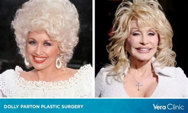 Dolly Parton talks plastic surgery 'I wasn't naturally pretty'