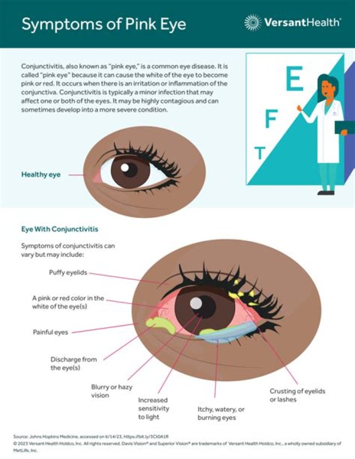 Eye Blog About.....Nothin' Jimmy, Butler, Basketball players