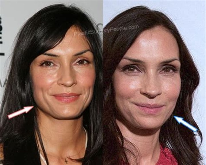 Famke Janssen BEFORE and AFTER 2022