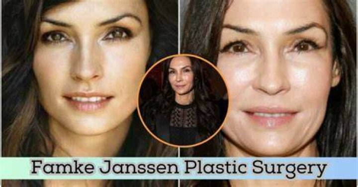 Famke Janssen Plastic Surgery A Look At Her Transformation After And