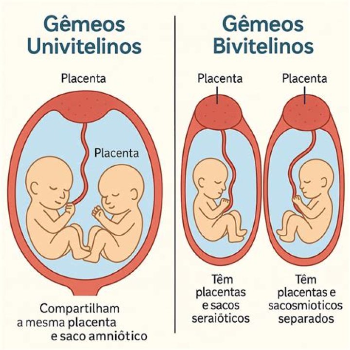 Gêmeos univitelinos O que são, como acontece e diferenças
