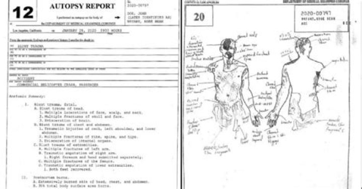 Gianna Bryant Autopsy Report Drawing Crazy Gameinstants