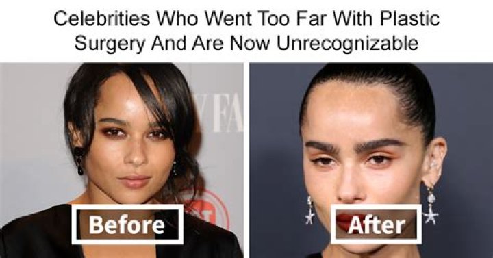 Gloria Plastic Surgery What Happened To Her? Family And Net