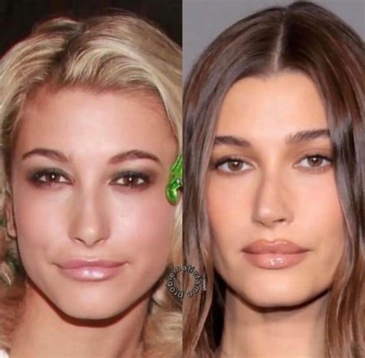 Hailey Bieber Nose Job An InDepth Look Cosmeticium
