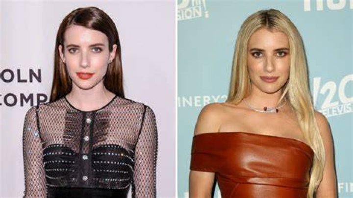 Has Emma Roberts Had Plastic Surgery? BeforeAndAfter Photos Life