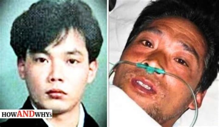 Hisashi Ouchi Was Kept Alive For 83 Days After Absorbing 17, 51 OFF