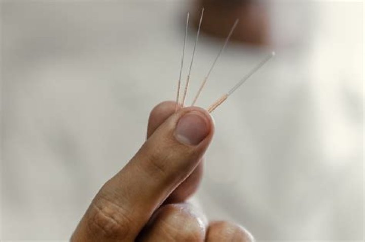 How Often Will I Need To Have Chiropractic Treatment?