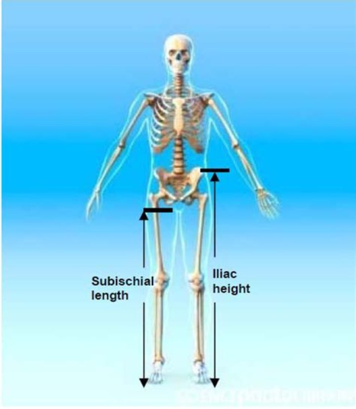 IJERPH Free FullText Leg Length, Body Proportion, and Health A
