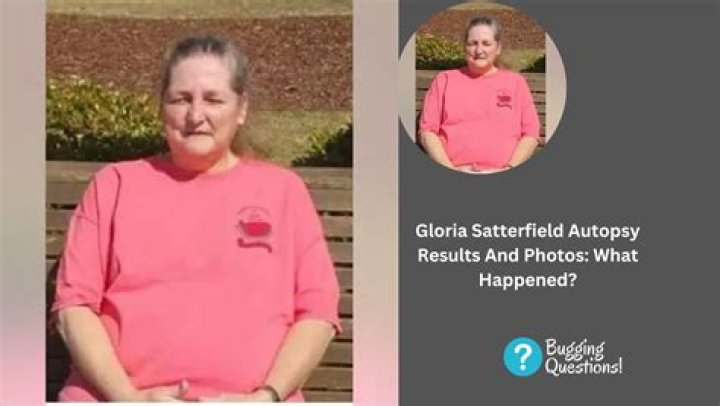 Is Gloria Sick What Happened To Her Face? Illness