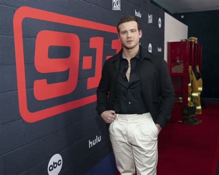 &lsquo;911&rsquo; Actor Oliver Stark on His Eye Birthmark It&rsquo;s Not Herpes