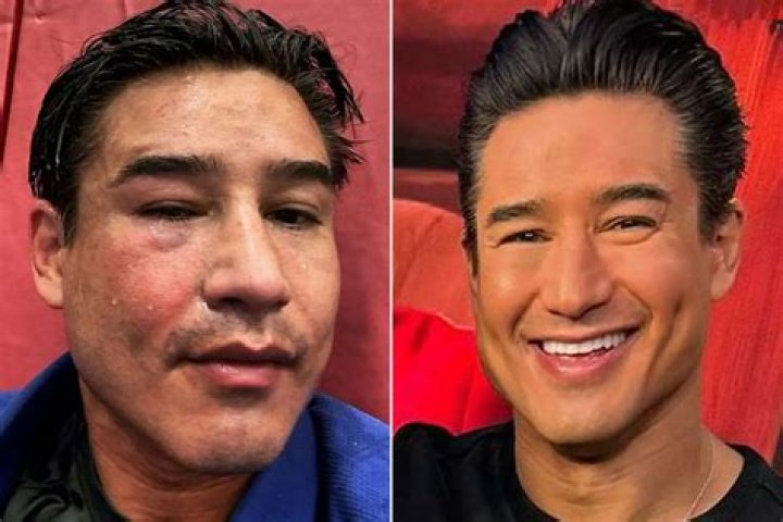 Mario Lopez Age, Bio, Birthday, Family, Net Worth National Today