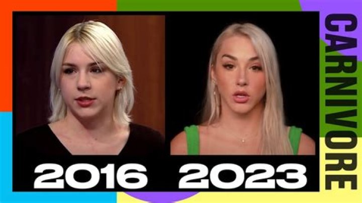 Mikhaila Peterson Plastic Surgery Before And After Photos