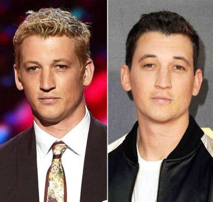 Miles Teller Debuted Blonde Hair, Eyebrows at the 2016 ESPYS