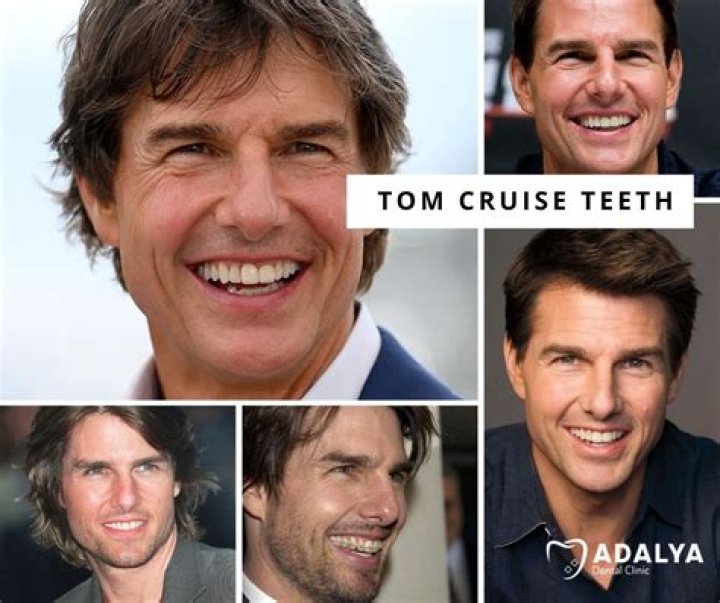 nadšení vyděšený obrubník tom cruise 1986 Vnímatelný mechanický Přispěvatel