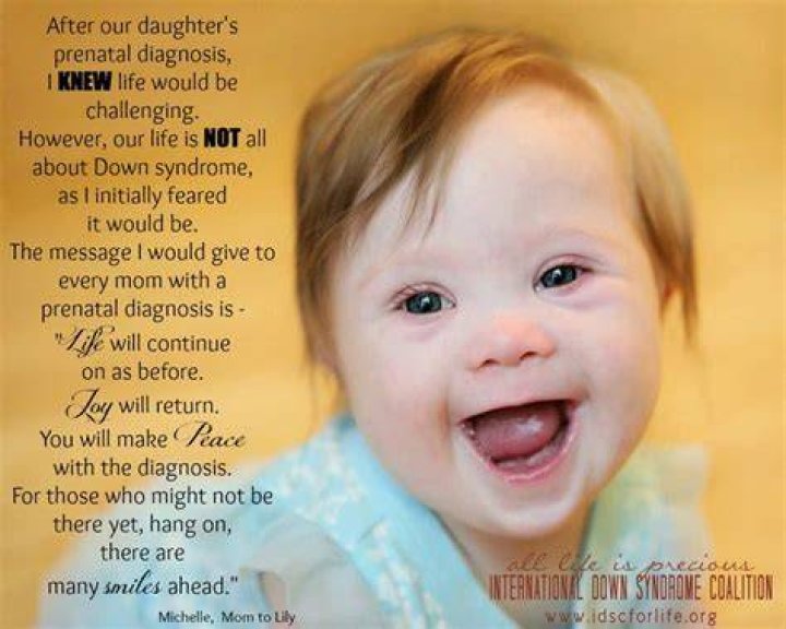 Pin on Down syndrome Information and Resources