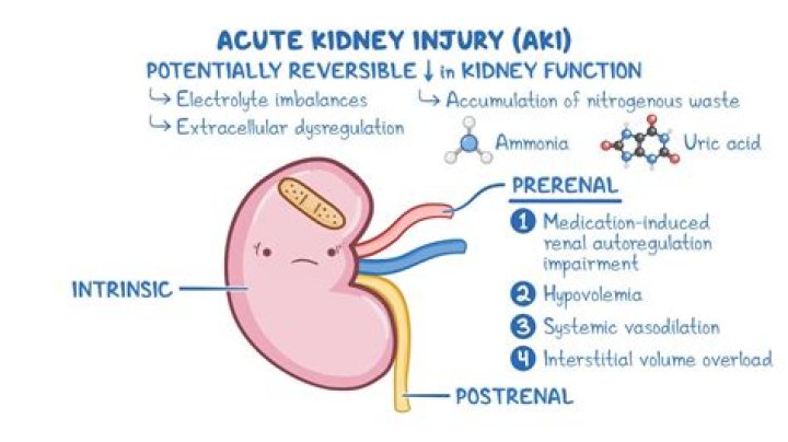 PPT Acute Kidney Injury (AKI) PowerPoint Presentation, free download