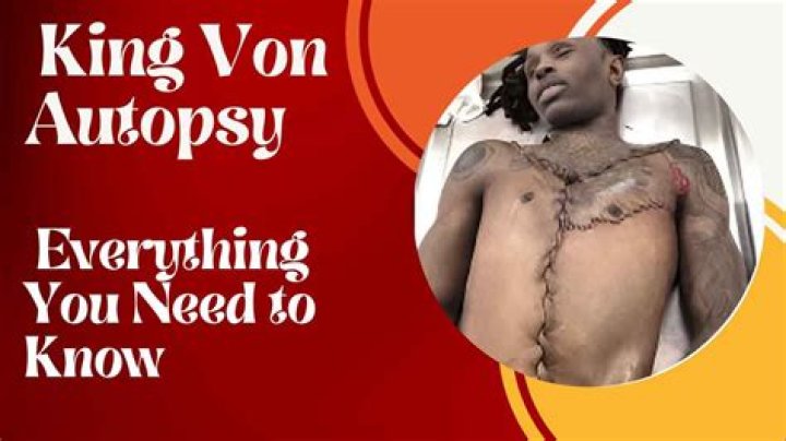 Rapper King Von Autopsy Photos WPD