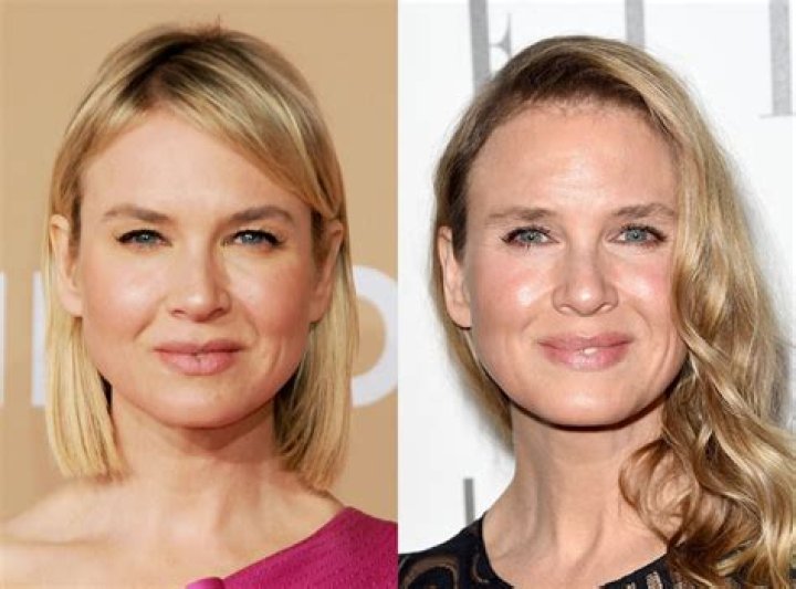 Ren&eacute;e Zellweger Explains Why Her Face Looks Different