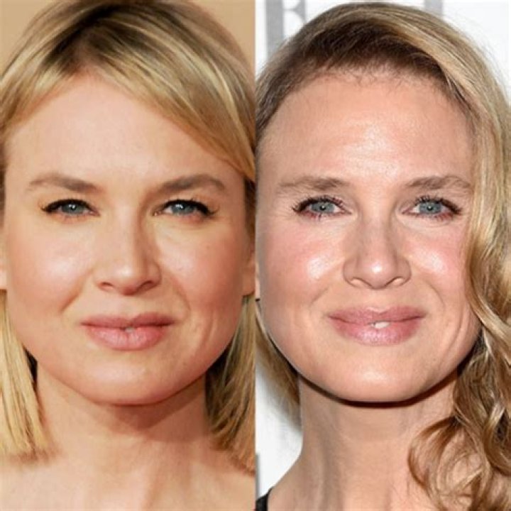 Renee Zellweger Then and Now
