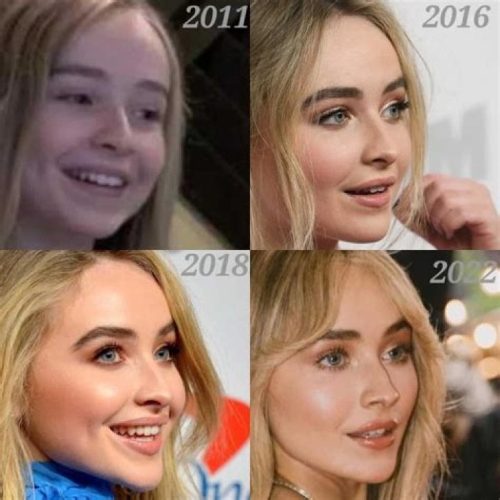 Sabrina Carpenter Plastische Chirurgie VorherNachher Fotos