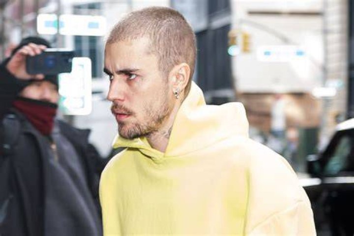 Sad News Justin Bieber is suffering from Ramsay Hunt Syndrome, reveals