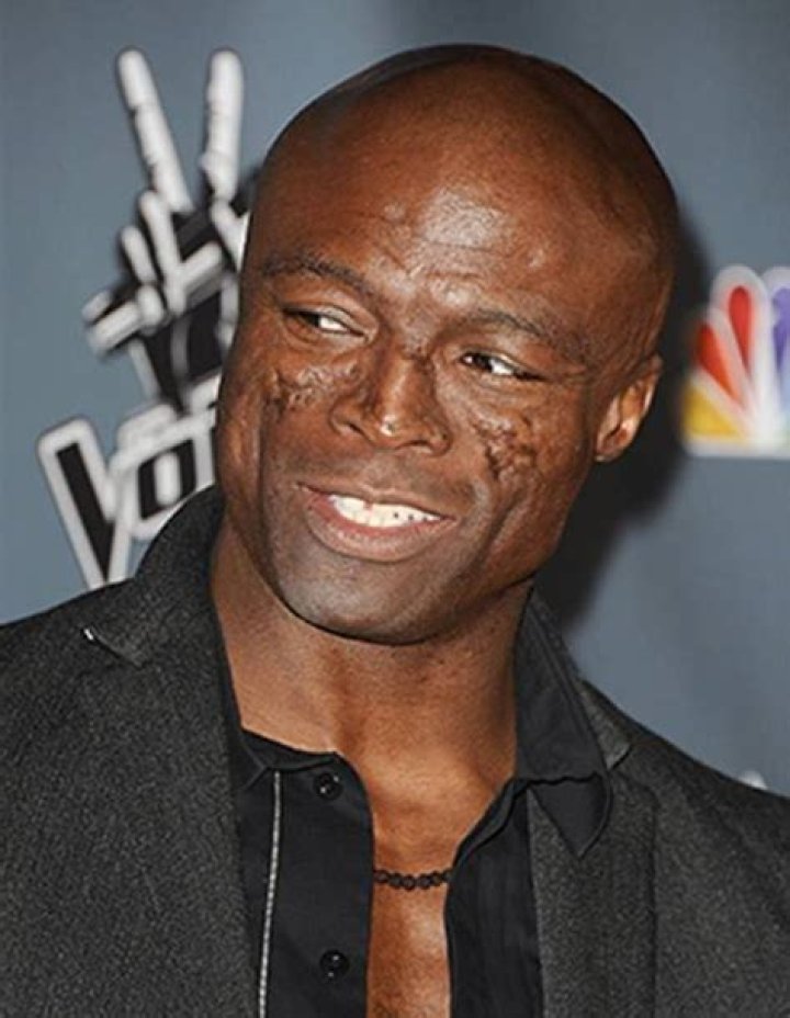 Seal Face, Seal (musician), Seal Singer, What Happened To Seals Face!