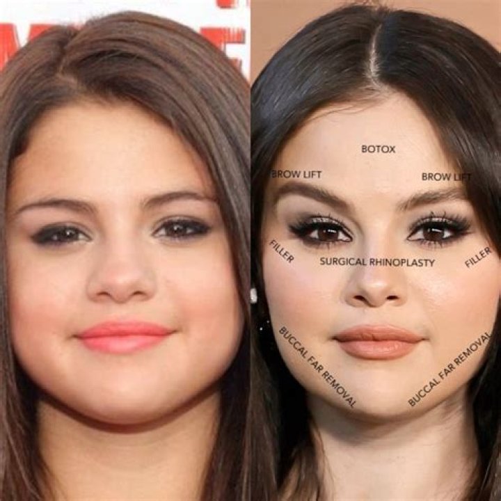 Selena Gomez Before and After From 2007 to 2024 The Skincare Edit