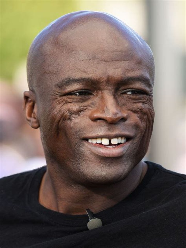 Singer Seal's Face Scars What Happened & Caused It? Was He Burned?