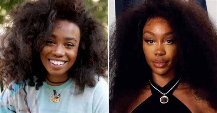 SZA Weight Loss Success Story Before and After, Diet & Surgery