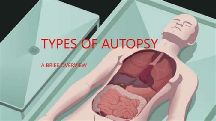 The autopsy for another victim of the... Death After Dark
