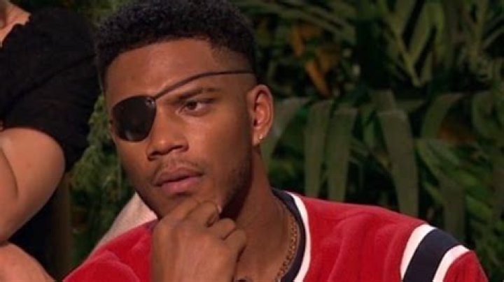 Theo Cambell from The Challenge How he got his eye injury, latest update