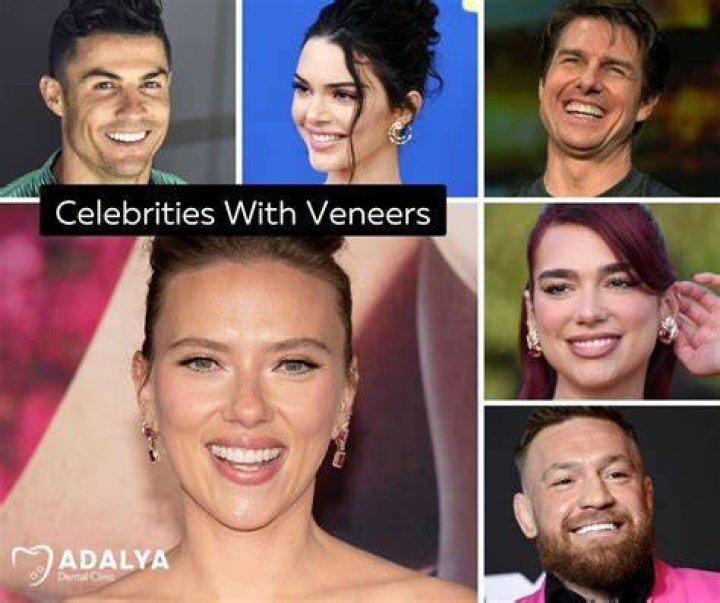 Top 10 Celebrities With Physical Deformities You May Have Never Noticed