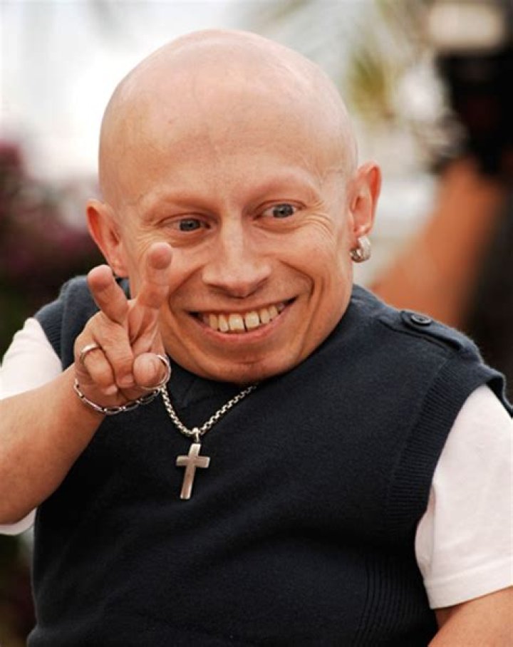 Ugly People Ugly Men Bald Headed Haircut Male Models Picture